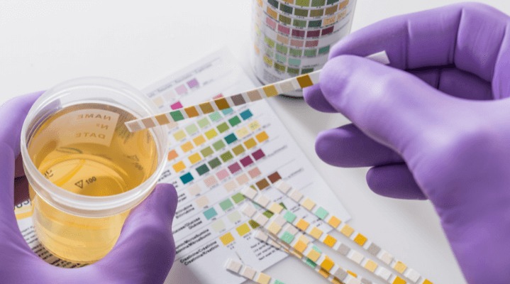 COlour-of-Urine-719x400-1