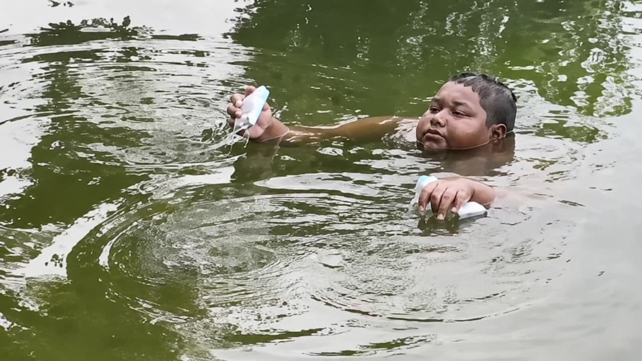 he-stays-in-a-pond-for-hours--as-coming-out-burns-his-skin-what-is-aquagenic-pruritus-image-x-100805566-16x9_0