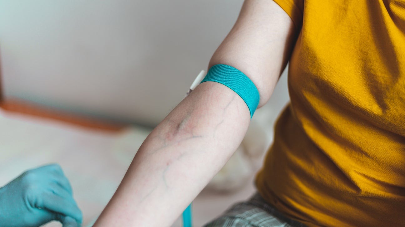 green-veins-1296x728-header